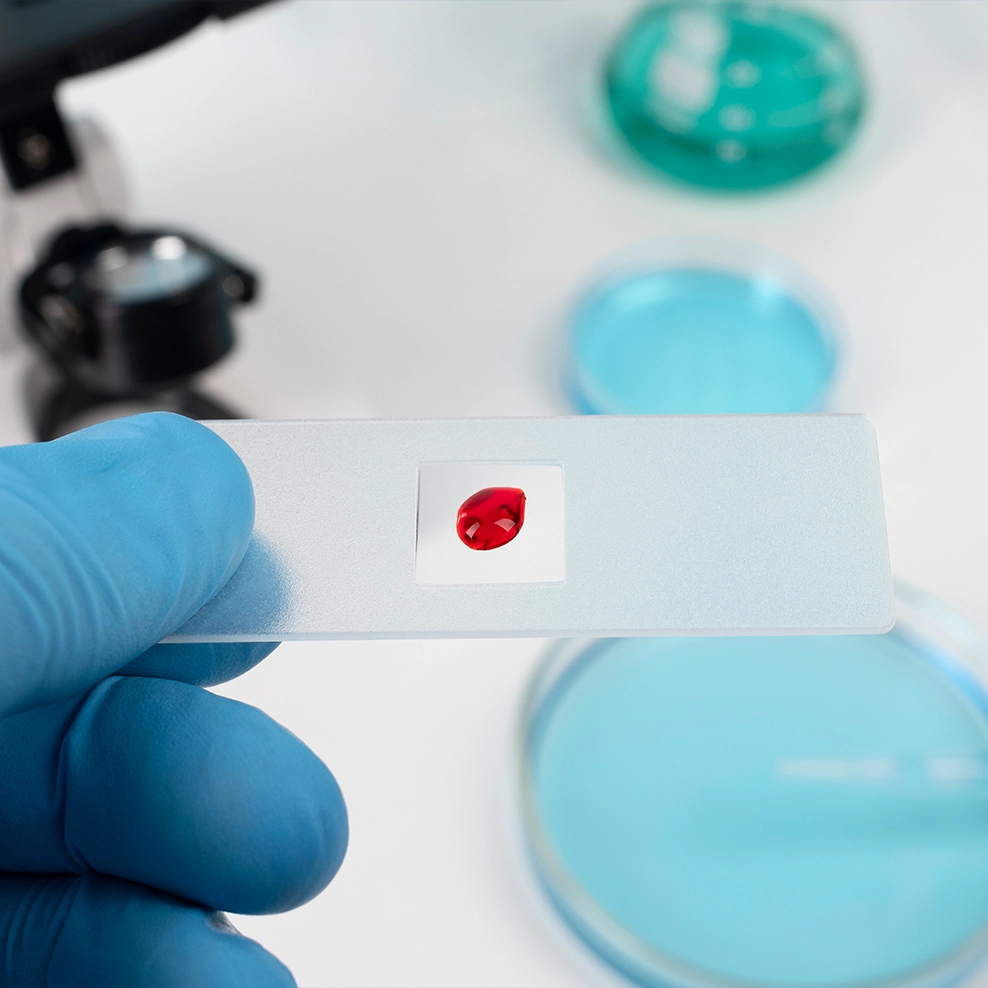 Platelet Secretome S